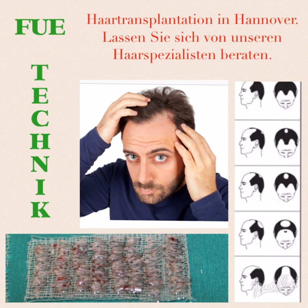 Haarausfall Ursachen Und Behandlung Hair Clinic Med